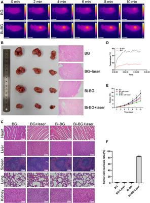 Bismuth-coated 80S15C bioactive glass scaffolds for photothermal antitumor therapy and bone regeneration